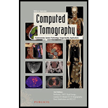 Computed Tomography: Fundamentals, System Technology, Image Quality, Applications