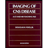 Computed Tomography of CNS Disease