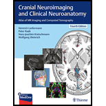 Cranial Neuroimaging and Clinical Neuroanatomy: Atlas of MR Imaging and Computed Tomography