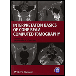 Interpretation Basics of Cone Beam Computed Tomography